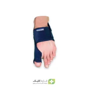 اسپیلنت هالوکس والگوس اپلون